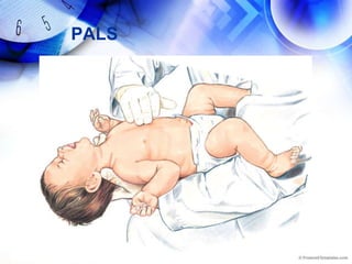 PALS