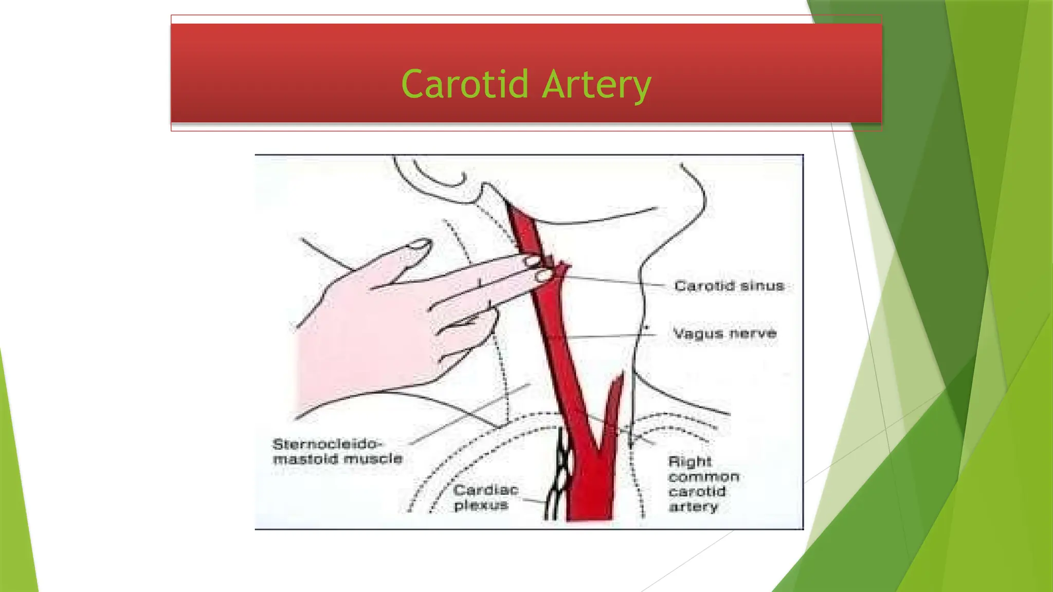 Carotid Artery
 