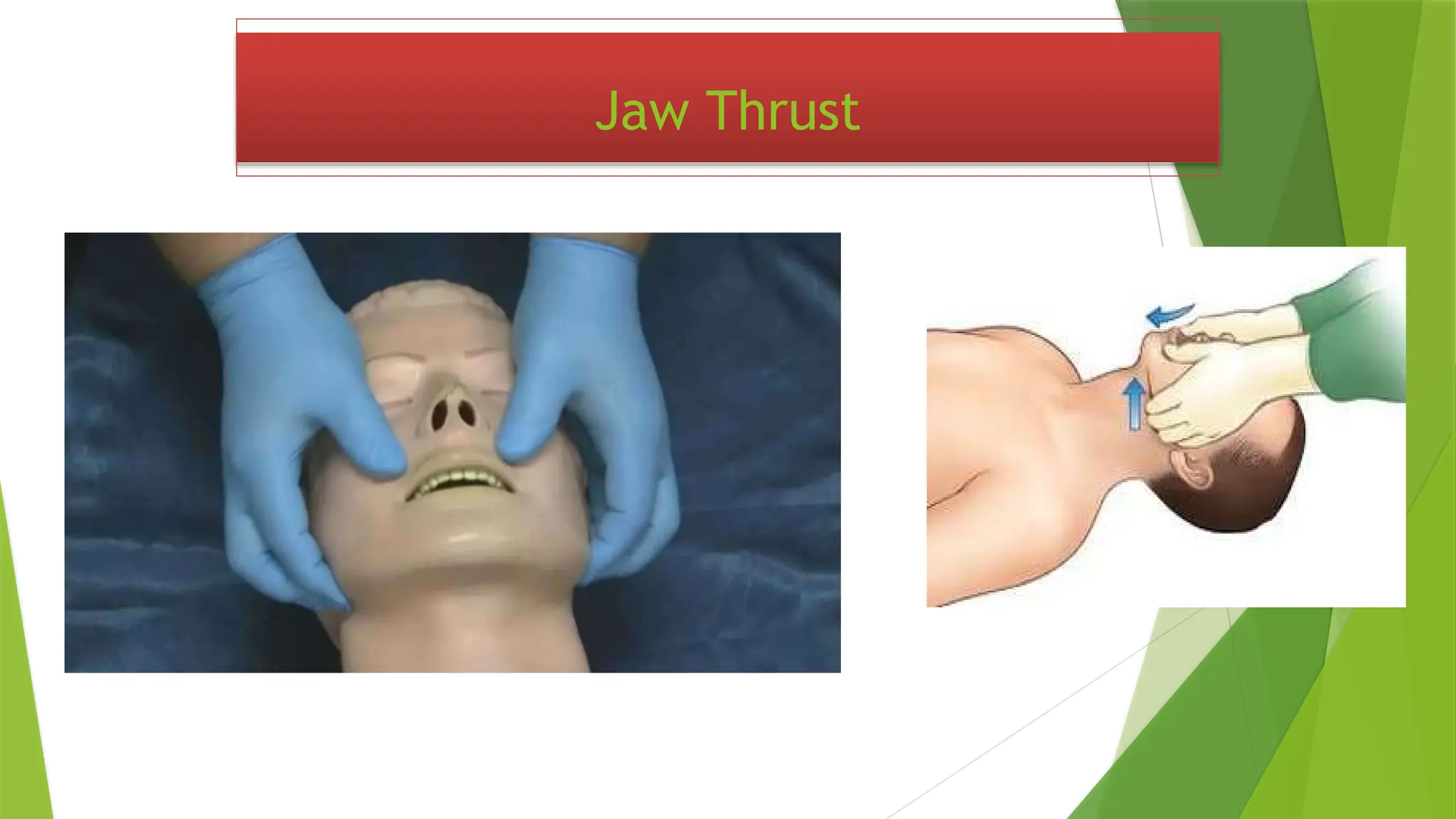 Jaw Thrust
 