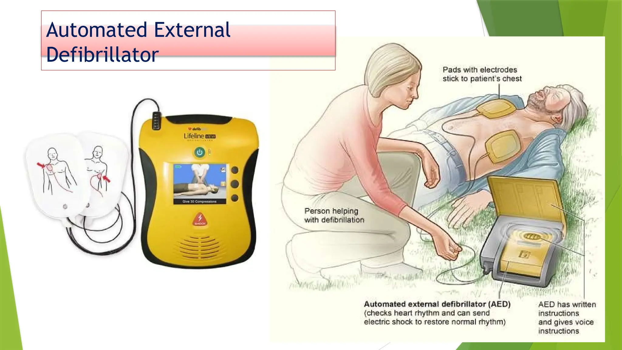 Automated External
Defibrillator
 