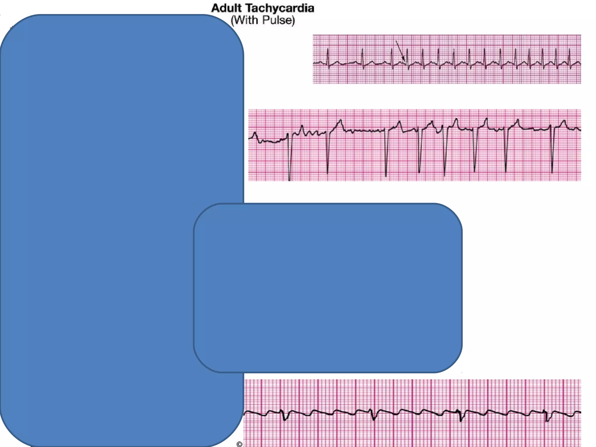 Bls and acls megacode --hui