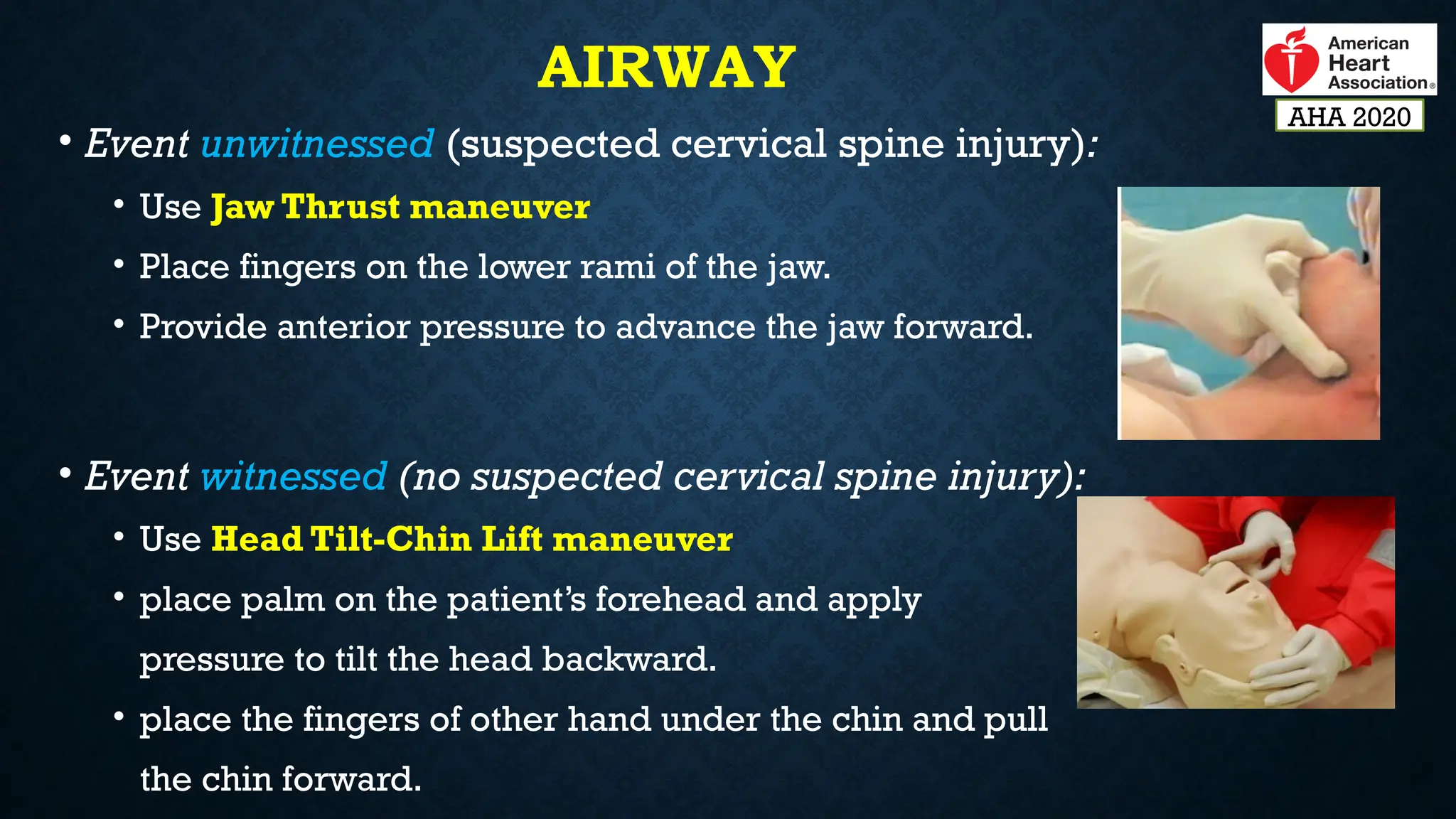 AIRWAY
• Event unwitnessed (suspected cervical spine injury):
• Use Jaw Thrust maneuver
• Place fingers on the lower rami of the jaw.
• Provide anterior pressure to advance the jaw forward.
• Event witnessed (no suspected cervical spine injury):
• Use Head Tilt-Chin Lift maneuver
• place palm on the patient’s forehead and apply
pressure to tilt the head backward.
• place the fingers of other hand under the chin and pull
the chin forward.
AHA 2020
 