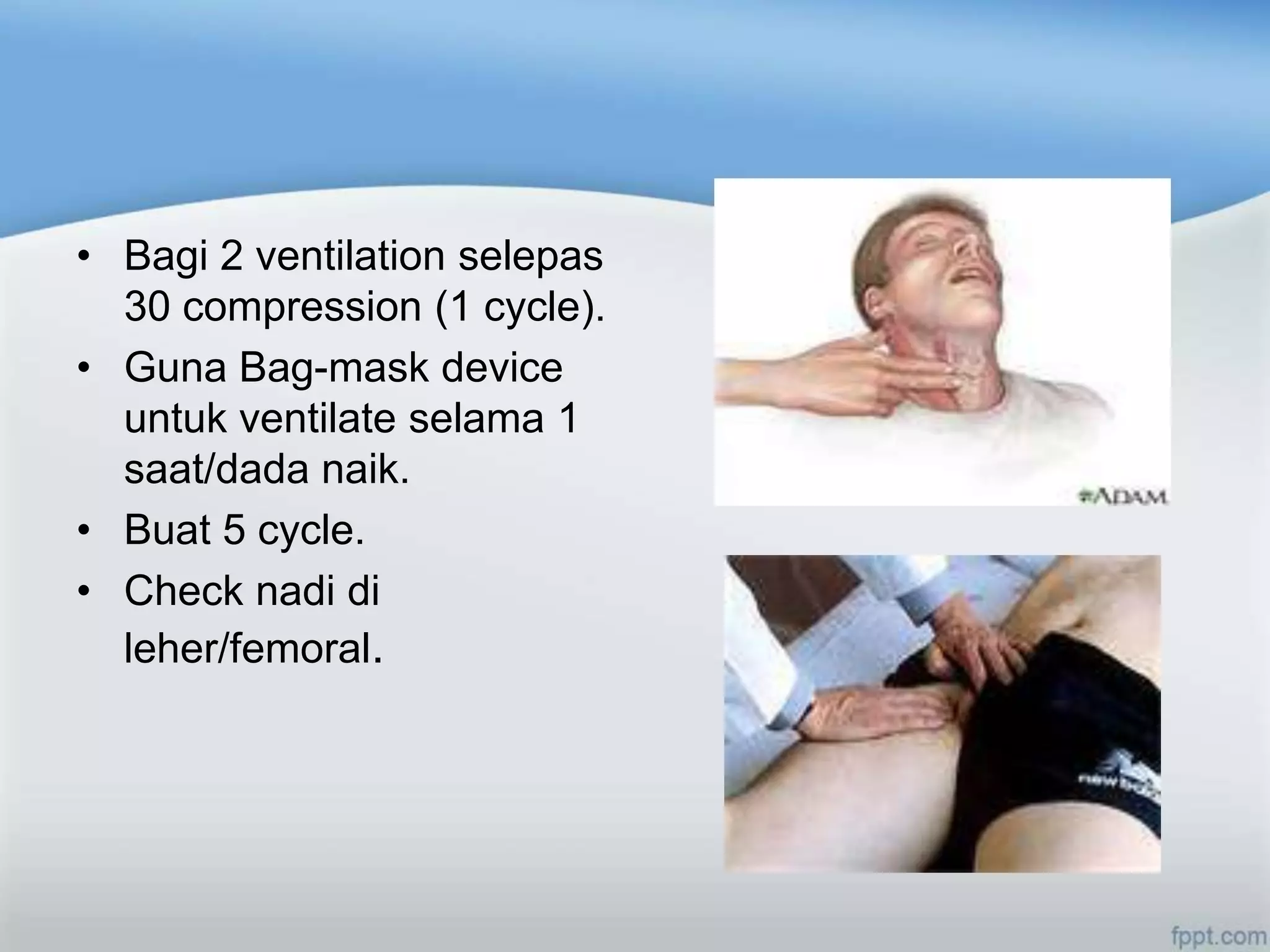 • Bagi 2 ventilation selepas
  30 compression (1 cycle).
• Guna Bag-mask device
  untuk ventilate selama 1
  saat/dada naik.
• Buat 5 cycle.
• Check nadi di
  leher/femoral.
 