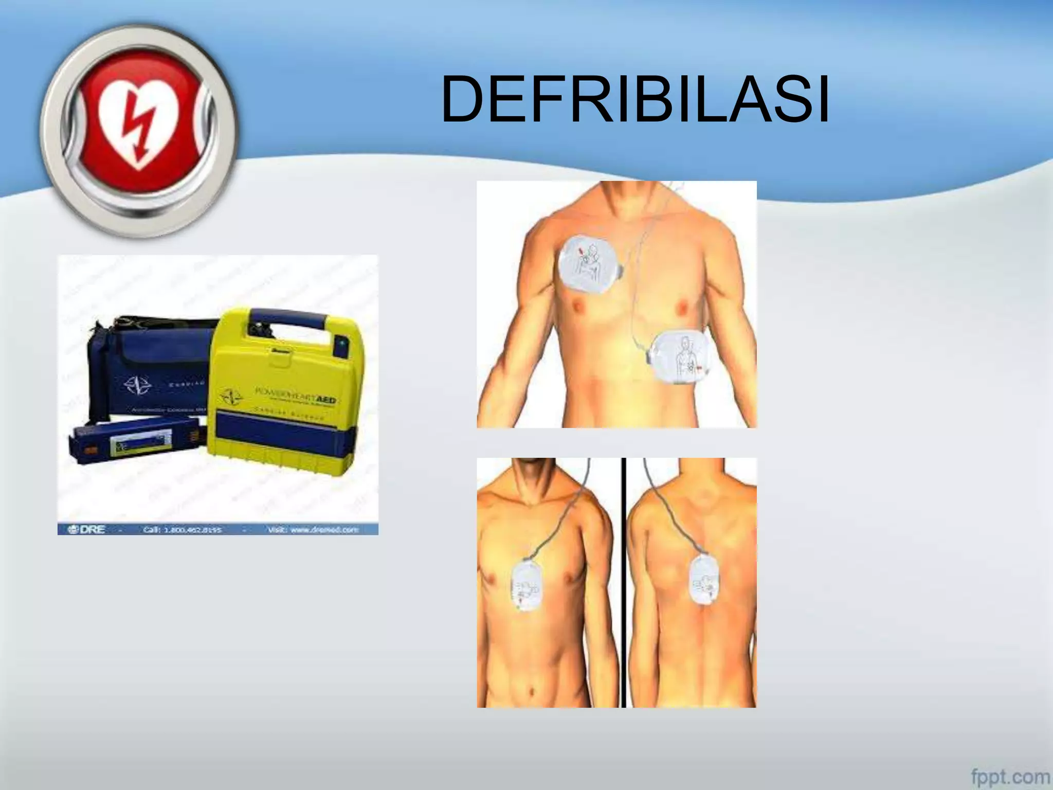 DEFRIBILASI
 
