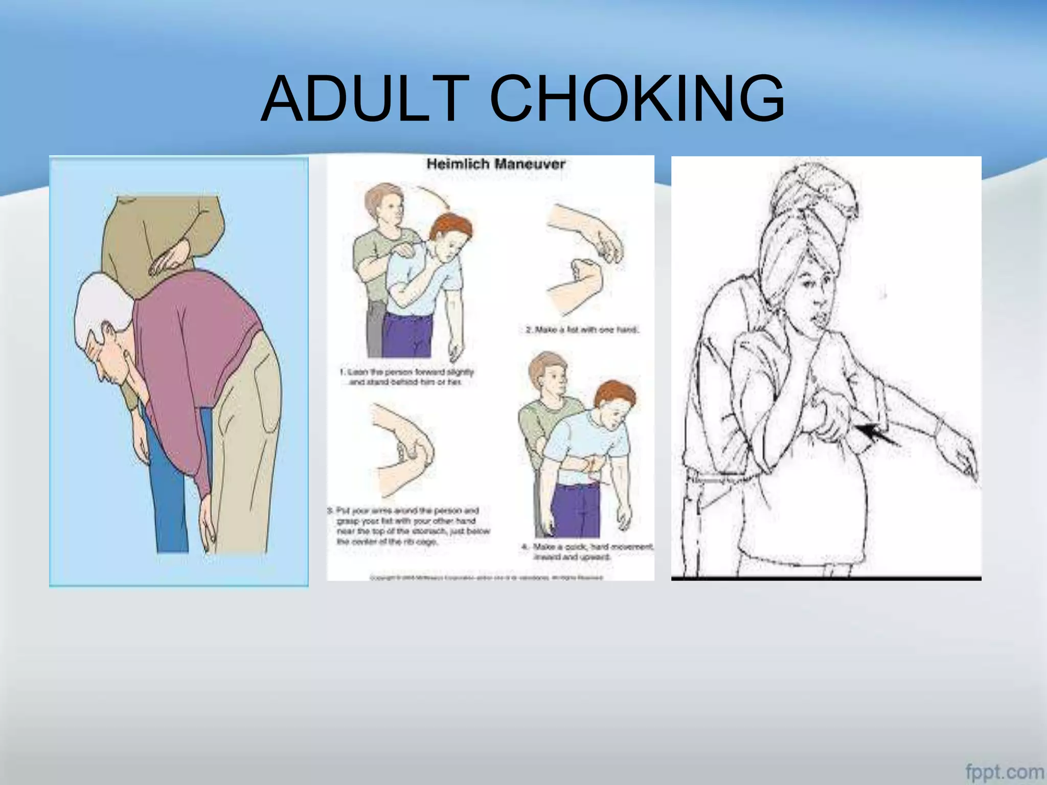 ADULT CHOKING
 