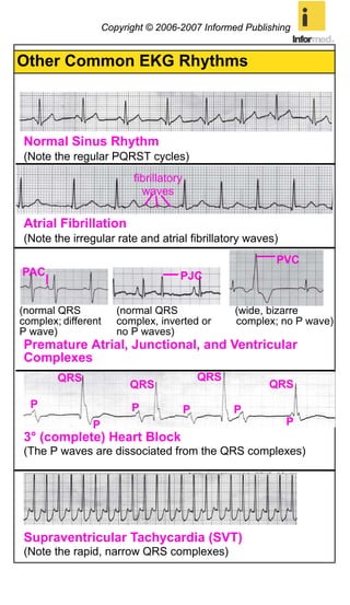 BLS_EGuide_tt_2.pdf
