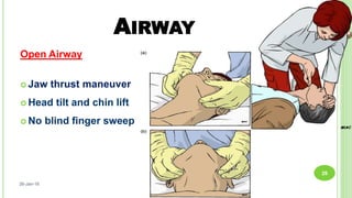 AIRWAY
Open Airway
 Jaw thrust maneuver
 Head tilt and chin lift
 No blind finger sweep
26-Jan-18
26
 