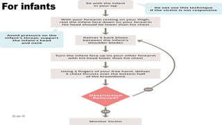 26-Jan-18
29
For infants
 