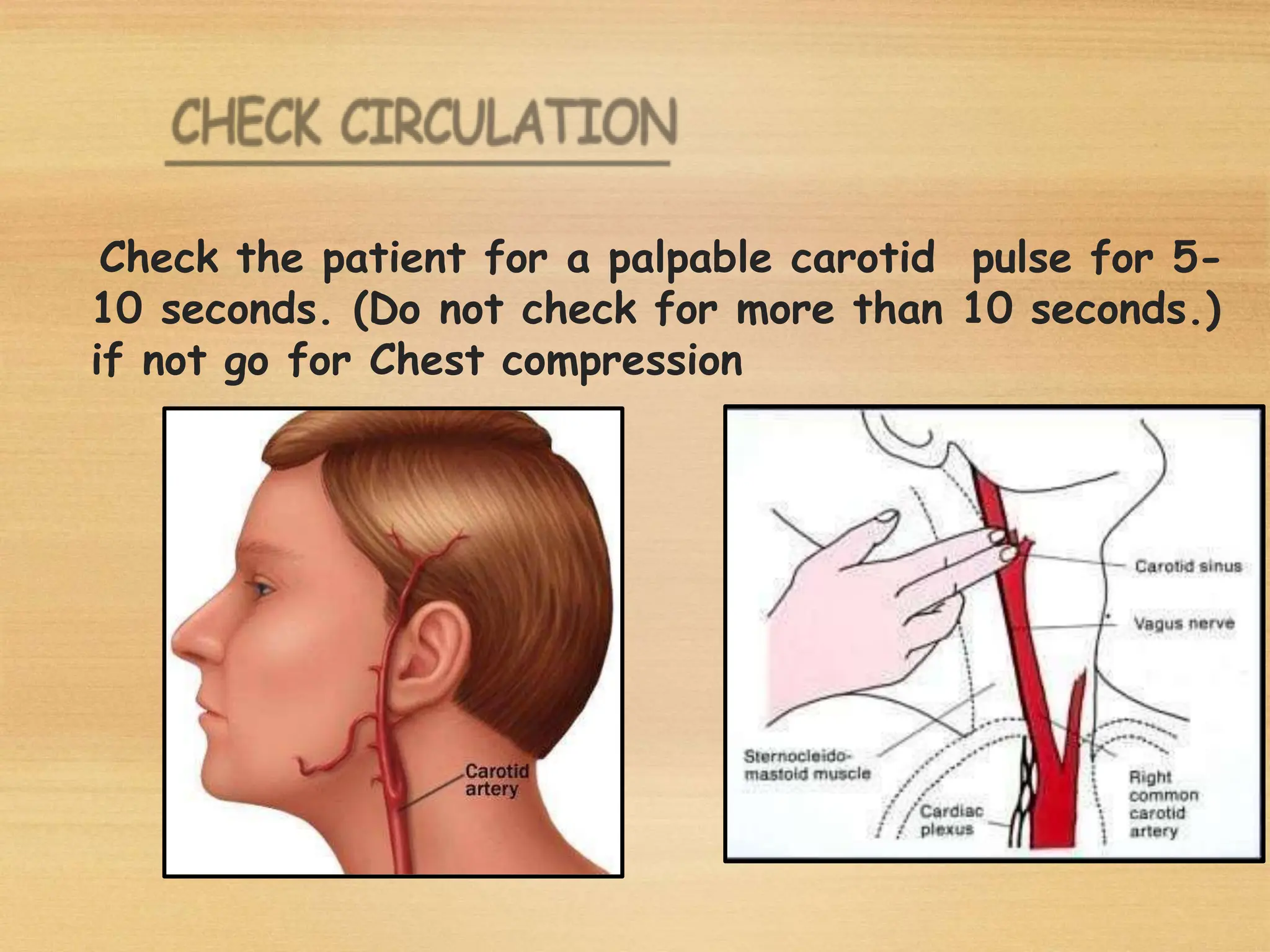 Check the patient for a palpable carotid pulse for 5-
10 seconds. (Do not check for more than 10 seconds.)
if not go for Chest compression
 