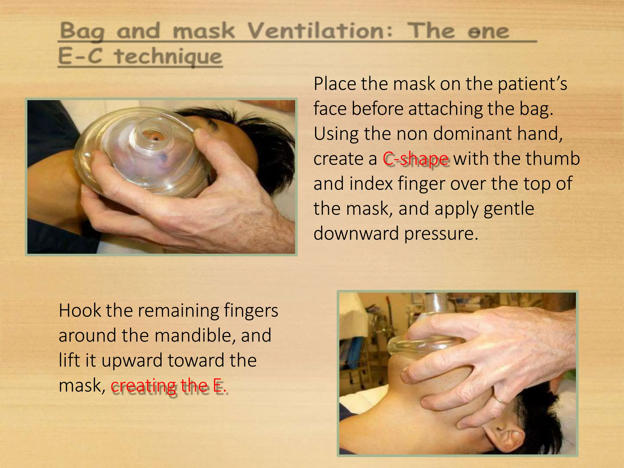 Place the mask on the patient’s
face before attaching the bag.
Using the non dominant hand,
create a C-shape with the thumb
and index finger over the top of
the mask, and apply gentle
downward pressure.
Hook the remaining fingers
around the mandible, and
lift it upward toward the
mask, creating the E.
 