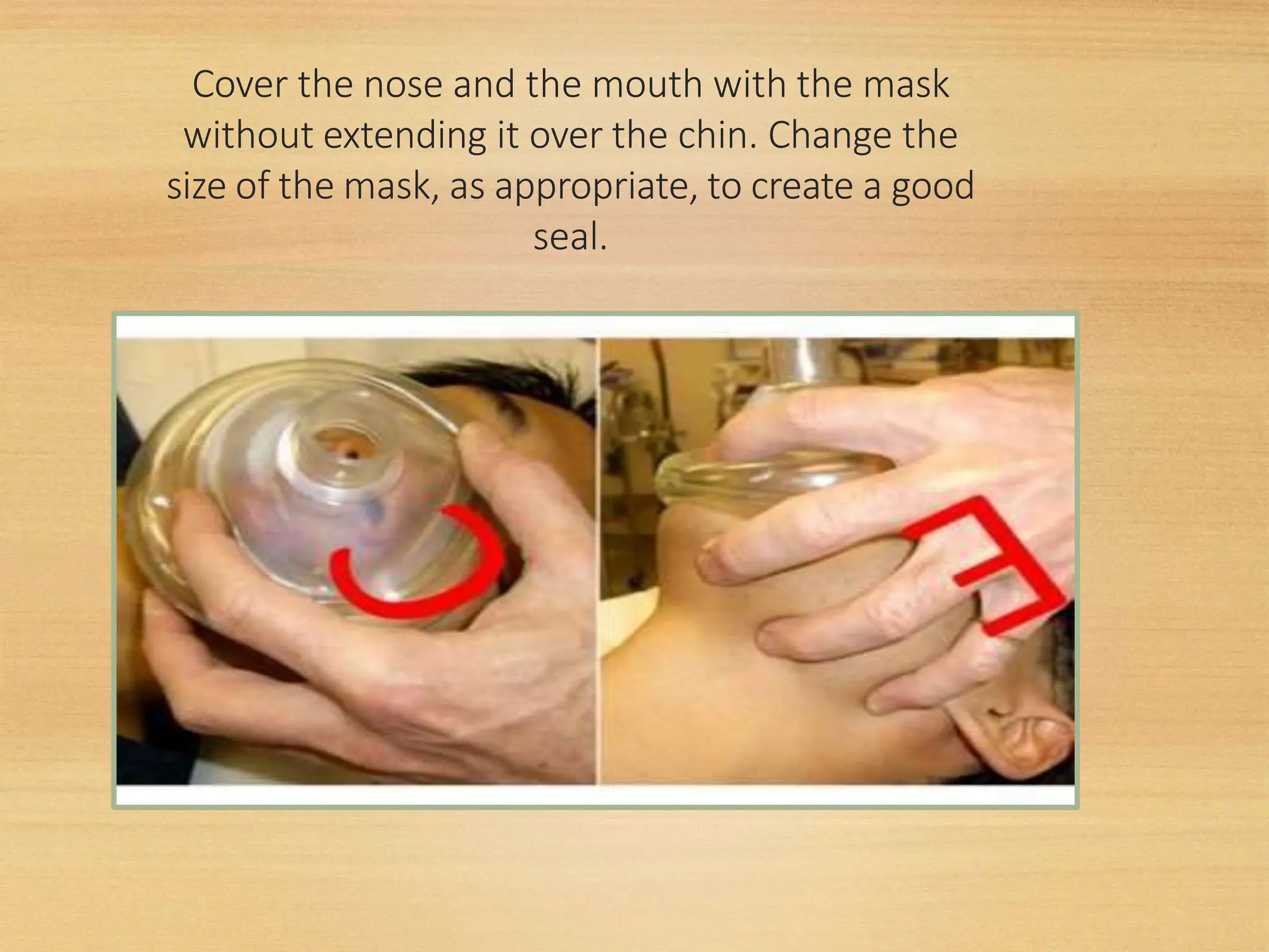 Cover the nose and the mouth with the mask
without extending it over the chin. Change the
size of the mask, as appropriate, to create a good
seal.
 
