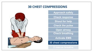 30 CHEST COMPRESSIONS
Approach safely
Check response
Shout for help
Open airway
Check breathing
Activate EMS
30 chest compressions
2 rescue breaths
Check the pulse
 