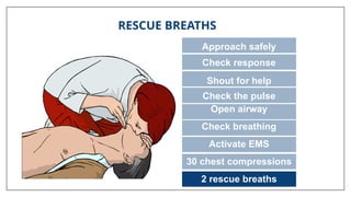 RESCUE BREATHS
Approach safely
Check response
Shout for help
Open airway
Check breathing
Activate EMS
30 chest compressions
2 rescue breaths
Check the pulse
 