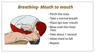Breathing- Mouth to mouth
• Pinch the nose
• Take a normal breath
• Place lips over mouth
• Blow until the chest
rises
• Take about 1 second
• Allow chest to fall
• Repeat
 