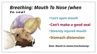 Breathing: Mouth To Nose (when
to use)
• Can’t open mouth
•Can’t make a good seal
• Severely injured mouth
•Stomach distension
Note- Mouth to stoma (tracheotomy)
 