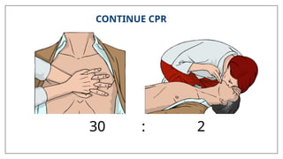 CONTINUE CPR
30 : 2
 