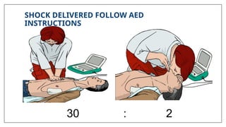 SHOCK DELIVERED FOLLOW AED
INSTRUCTIONS
30 : 2
 