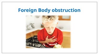 Foreign Body obstruction
 