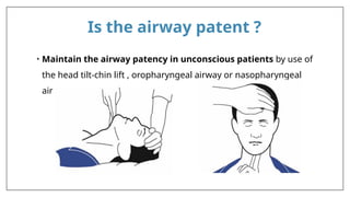Is the airway patent ?
• Maintain the airway patency in unconscious patients by use of
the head tilt-chin lift , oropharyngeal airway or nasopharyngeal
airway
 