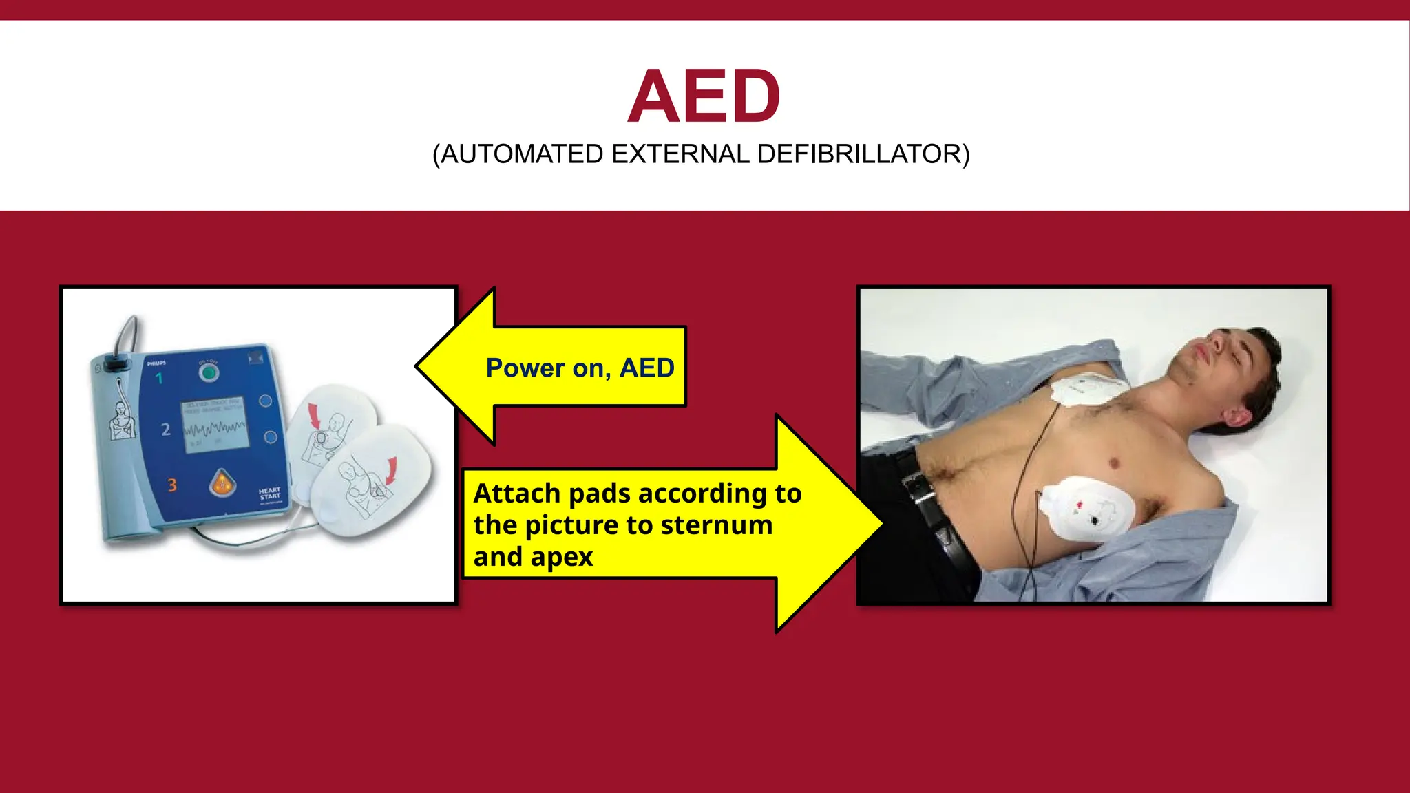 BLS ( Adult Basic Life Support ) 2025.pptx