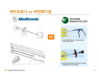 BLT patent & law firm
메드트로닉 vs 태연메디컬
46
VS
 