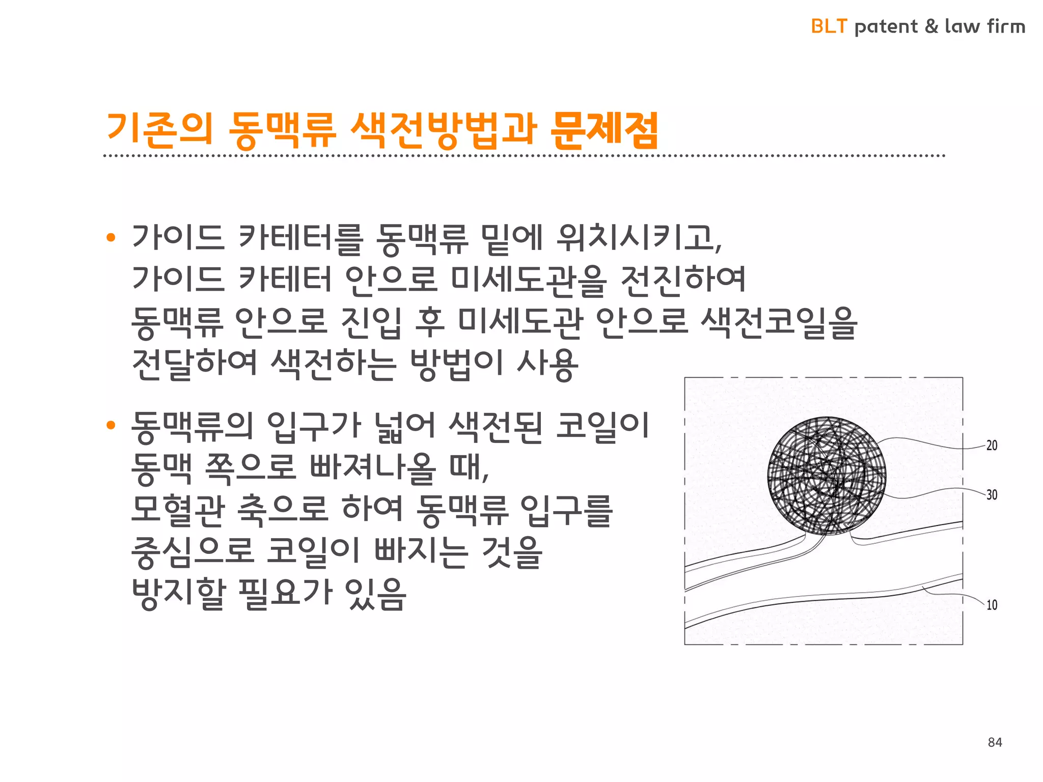 BLT patent & law firm
기존의 동맥류 색전방법과 문제점
• 가이드 카테터를 동맥류 밑에 위치시키고,
가이드 카테터 안으로 미세도관을 전진하여
동맥류 안으로 진입 후 미세도관 안으로 색전코일을
전달하여 색전하는 방법이 사용
• 동맥류의 입구가 넓어 색전된 코일이
동맥 쪽으로 빠져나올 때,
모혈관 축으로 하여 동맥류 입구를
중심으로 코일이 빠지는 것을
방지할 필요가 있음
84
 