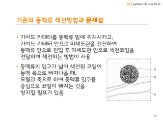 BLT patent & law firm
기존의 동맥류 색전방법과 문제점
• 가이드 카테터를 동맥류 밑에 위치시키고,
가이드 카테터 안으로 미세도관을 전진하여
동맥류 안으로 진입 후 미세도관 안으로 색전코일을
전달하여 색전하는 방법이 사용
• 동맥류의 입구가 넓어 색전된 코일이
동맥 쪽으로 빠져나올 때,
모혈관 축으로 하여 동맥류 입구를
중심으로 코일이 빠지는 것을
방지할 필요가 있음
84
 