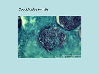 Coccidioides immitis 