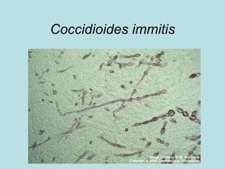Coccidioides immitis 
