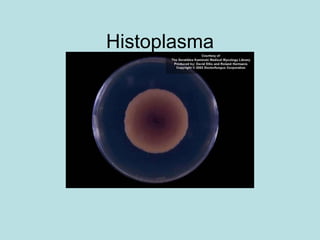 Histoplasma 