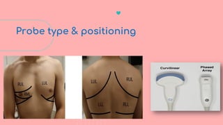 Lev Protocol Pocus Bedside Ultrasound (BLUE Protocol): Advanced POCUS in Critical Care | PDF
