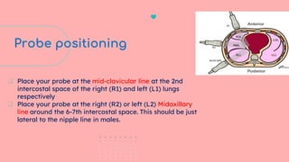 Bedside Ultrasound (BLUE Protocol): Advanced POCUS in Critical Care | PDF