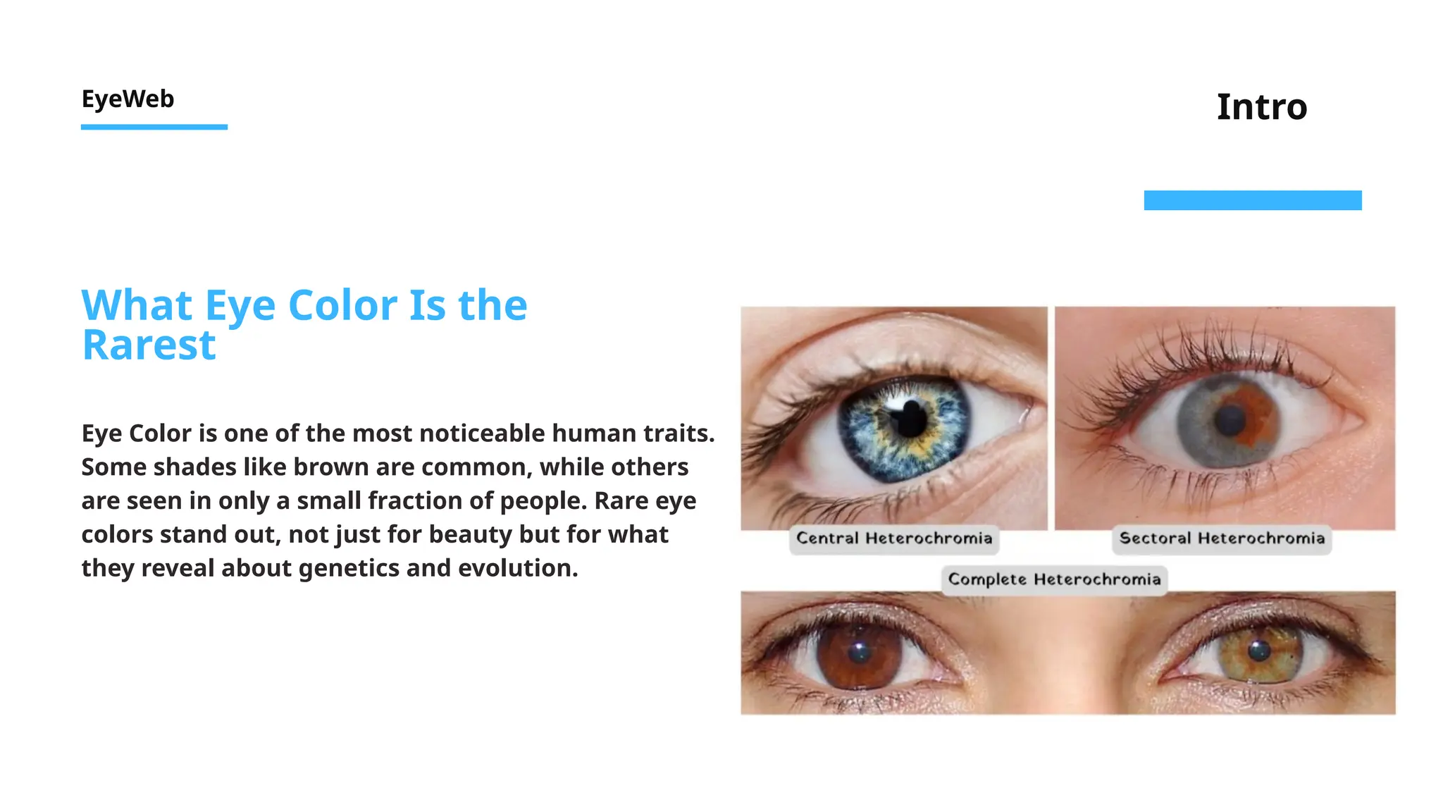 Genetic Art: The Rare Colors of Human Eyes | PPTX
