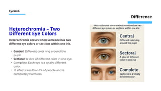 Human Color Genetics Genetic Art: The Rare Colors of Human Eyes | PPTX