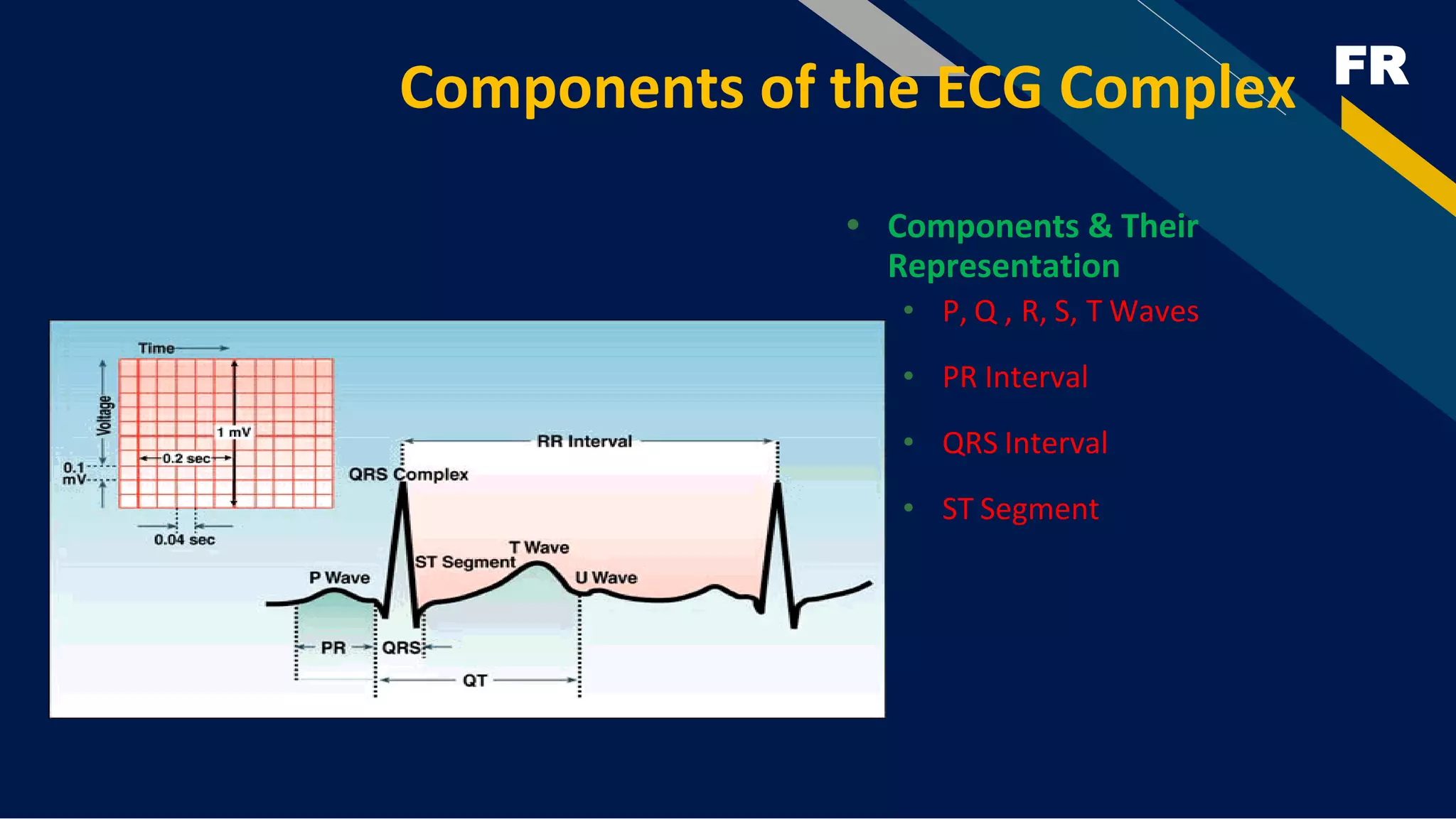 FR
Components of the ECG Complex
• Components & Their
Representation
• P, Q , R, S, T Waves
• PR Interval
• QRS Interval
• ST Segment
 