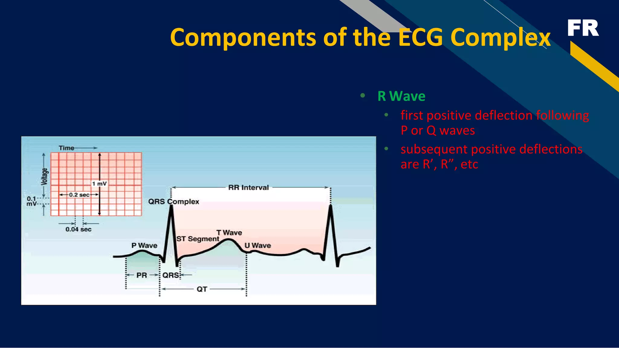 FR
Components of the ECG Complex
• R Wave
• first positive deflection following
P or Q waves
• subsequent positive deflections
are R’, R”, etc
 