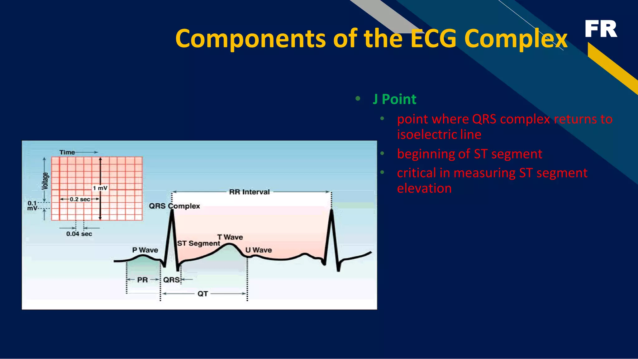 FR
Components of the ECG Complex
• J Point
• point where QRS complex returns to
isoelectric line
• beginning of ST segment
• critical in measuring ST segment
elevation
 