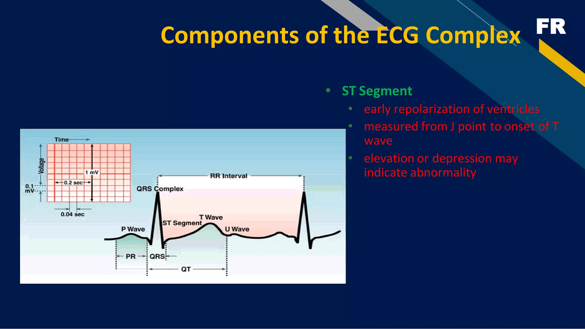 FR
Components of the ECG Complex
• ST Segment
• early repolarization of ventricles
• measured from J point to onset of T
wave
• elevation or depression may
indicate abnormality
 