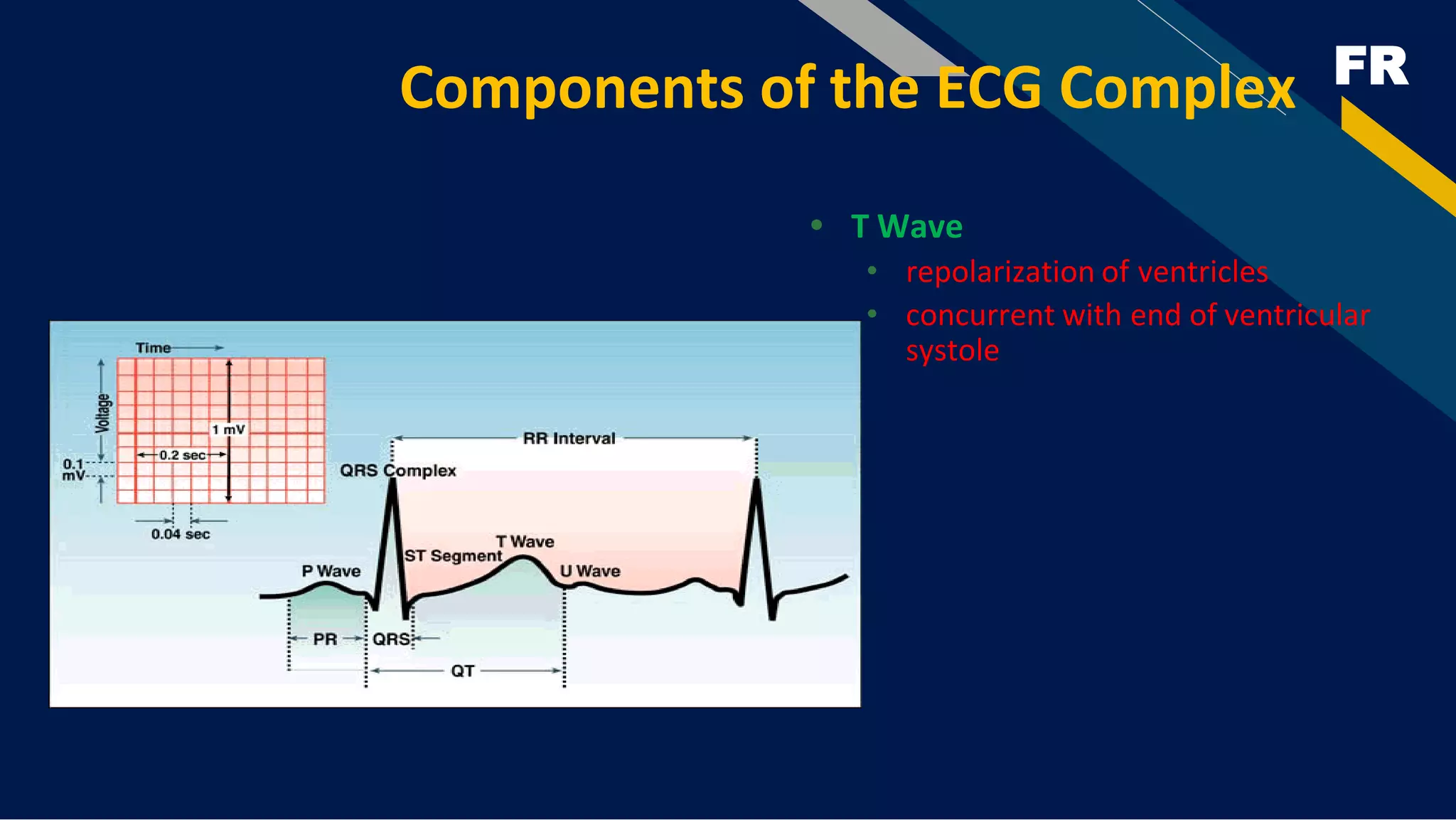 FR
Components of the ECG Complex
• T Wave
• repolarization of ventricles
• concurrent with end of ventricular
systole
 