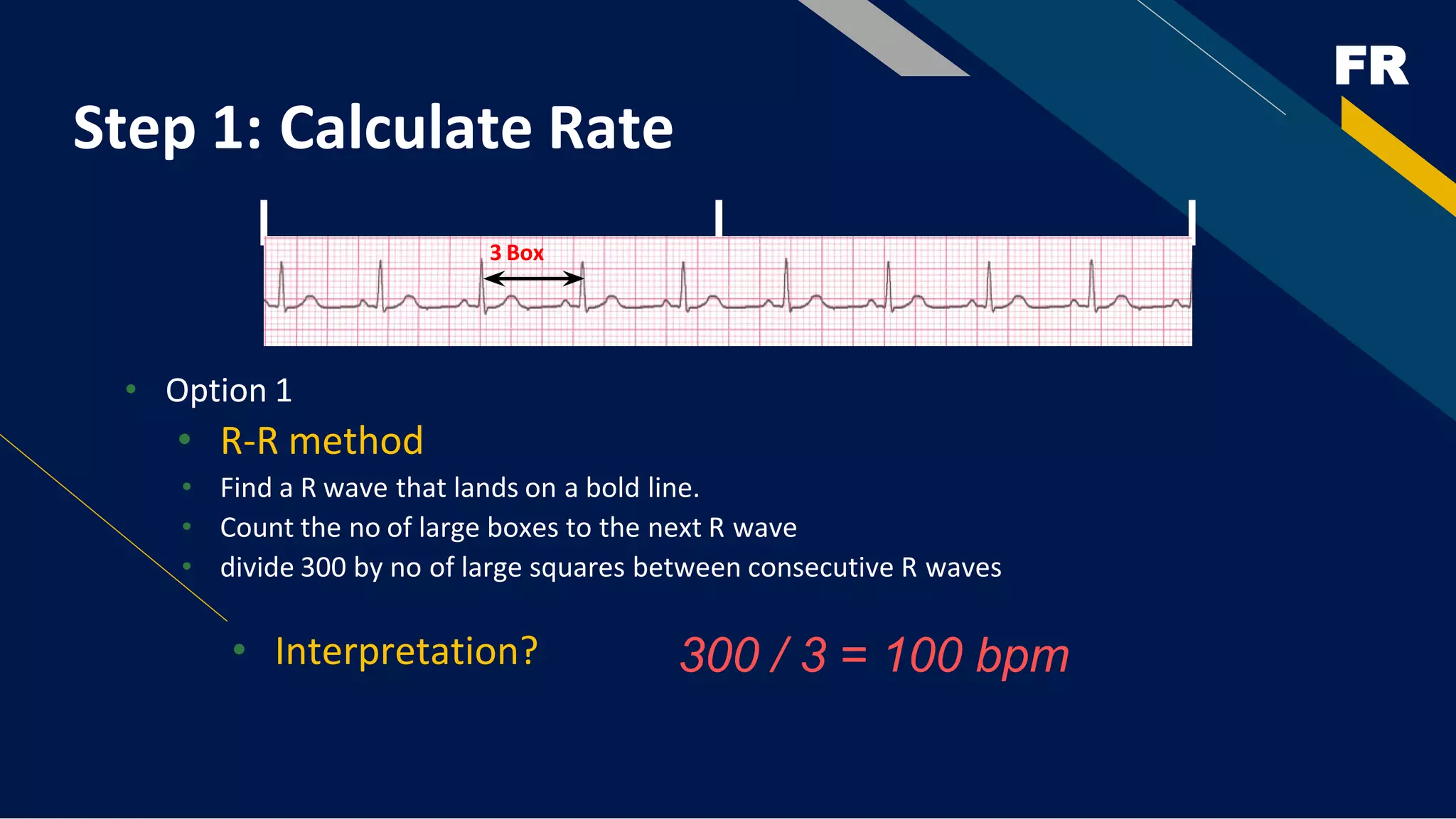 FR
Step 1: Calculate Rate
• Option 1
• R-R method
• Find a R wave that lands on a bold line.
• Count the no of large boxes to the next R wave
• divide 300 by no of large squares between consecutive R waves
• Interpretation? 300 / 3 = 100 bpm
3 Box
 
