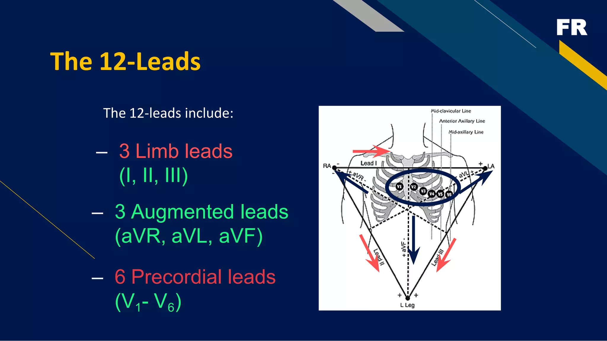 FR
The 12-Leads
The 12-leads include:
– 3 Limb leads
(I, II, III)
– 3 Augmented leads
(aVR, aVL, aVF)
– 6 Precordial leads
(V1- V6)
 