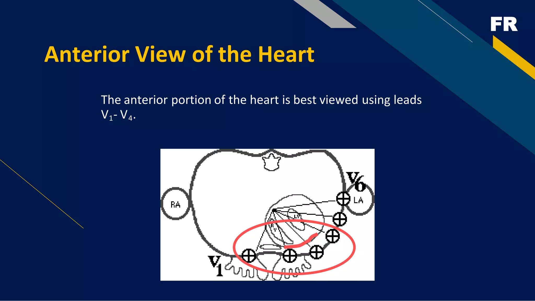 FR
Anterior View of the Heart
The anterior portion of the heart is best viewed using leads
V1- V4.
 