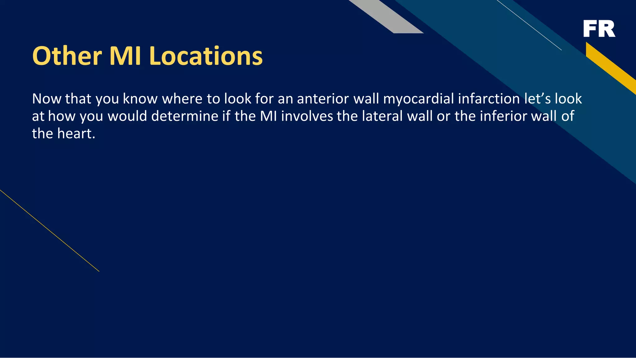 FR
Other MI Locations
Now that you know where to look for an anterior wall myocardial infarction let’s look
at how you would determine if the MI involves the lateral wall or the inferior wall of
the heart.
 