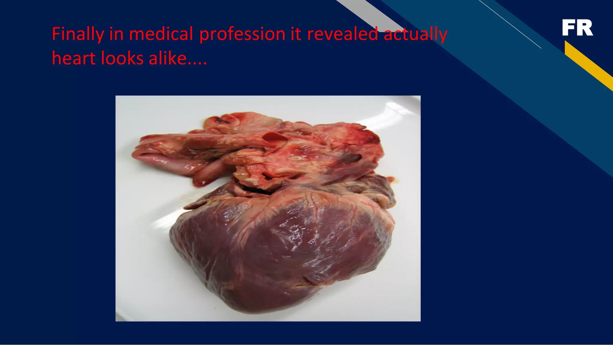 FR
Finally in medical profession it revealed actually
heart looks alike....
 
