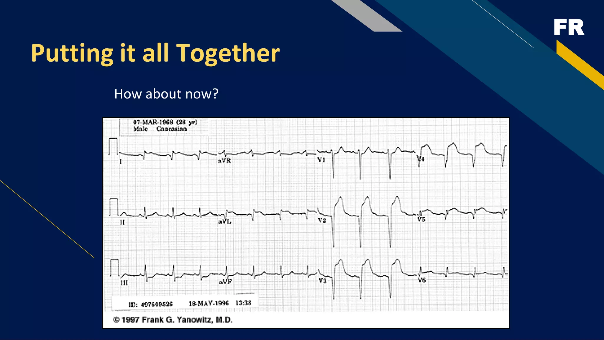 FR
Putting it all Together
How about now?
 