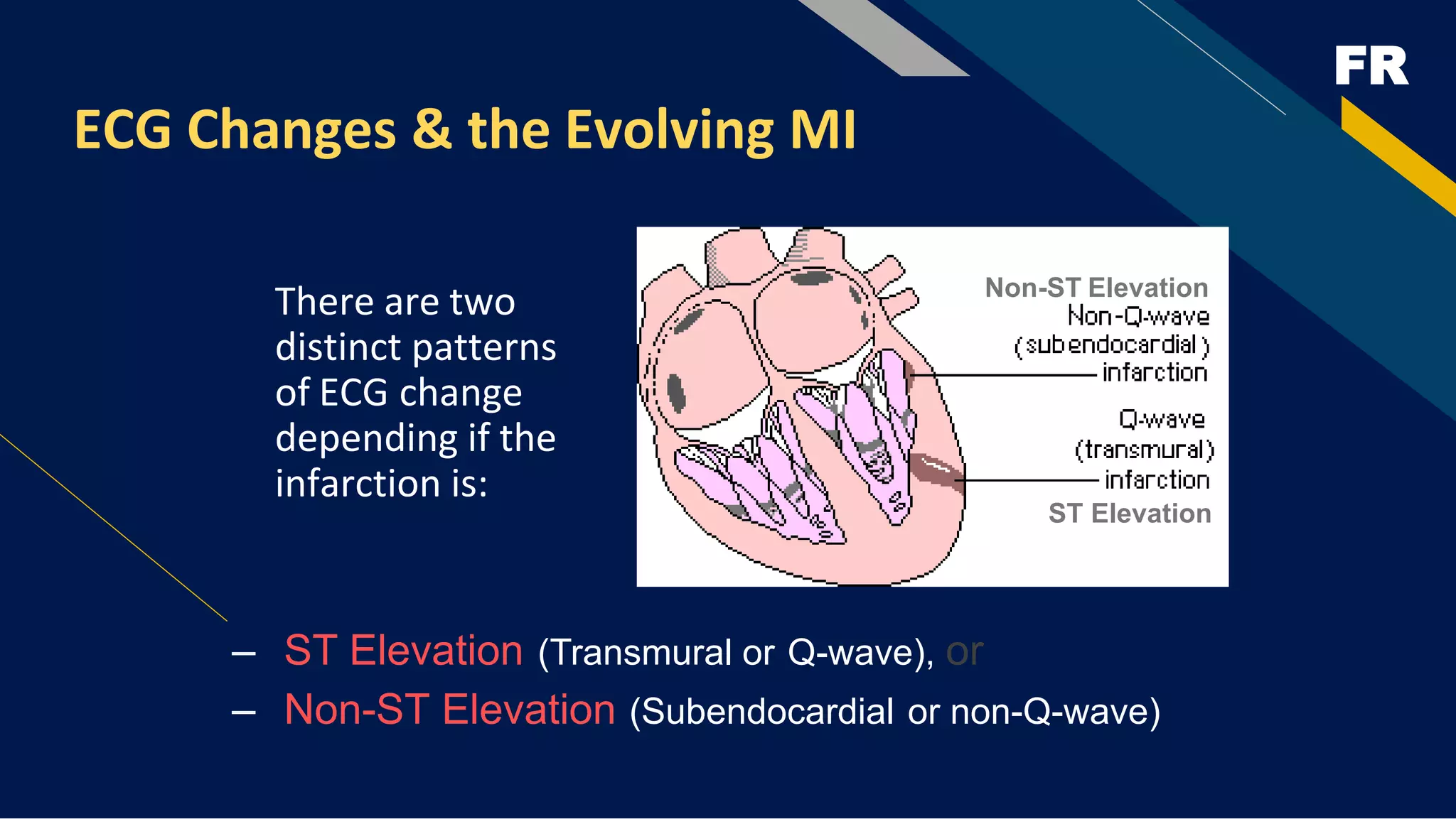 FR
ECG Changes & the Evolving MI
There are two
distinct patterns
of ECG change
depending if the
infarction is:
– ST Elevation (Transmural or Q-wave), or
– Non-ST Elevation (Subendocardial or non-Q-wave)
Non-ST Elevation
ST Elevation
 