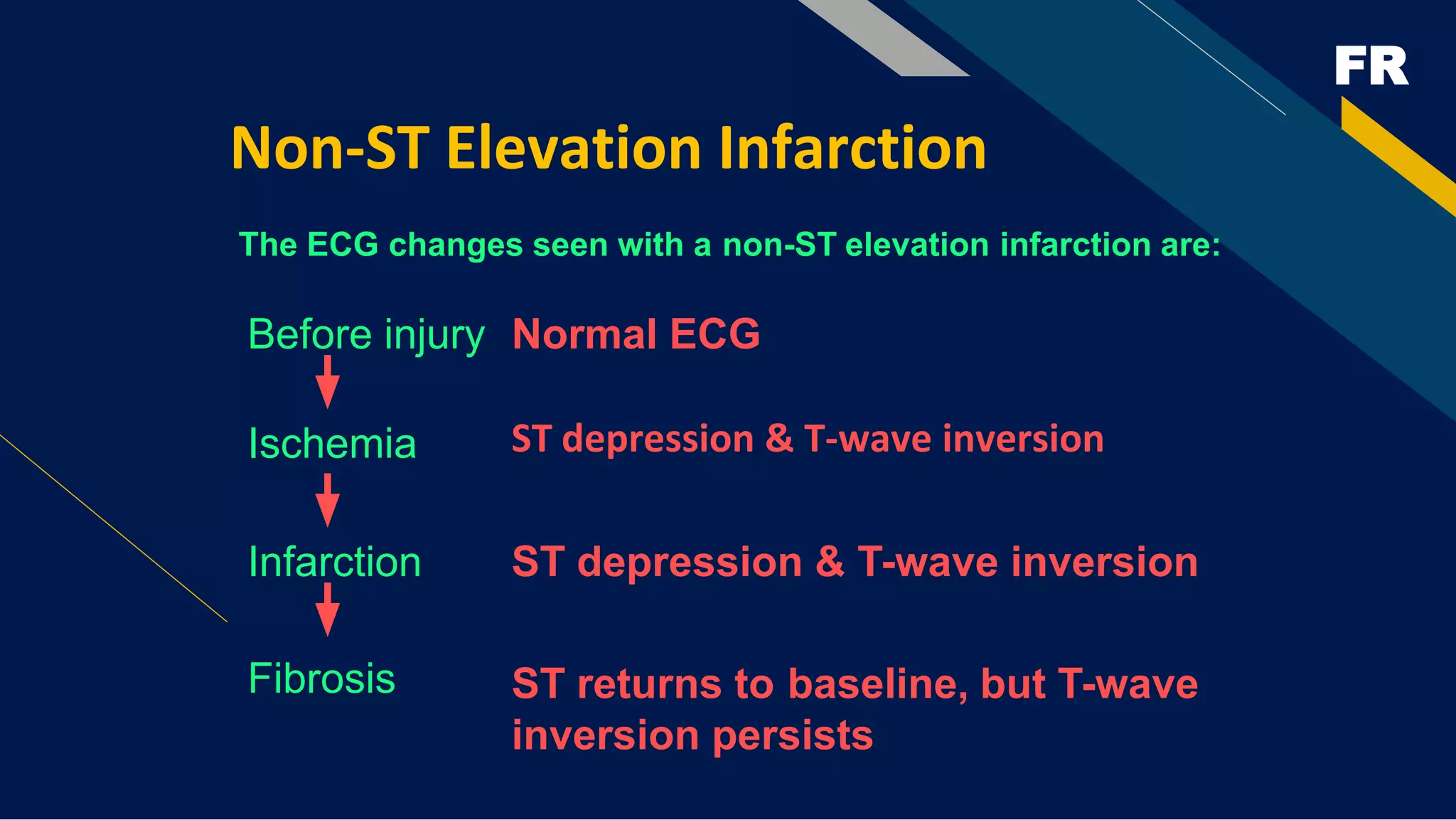 FR
Non-ST Elevation Infarction
ST depression & T-wave inversion
The ECG changes seen with a non-ST elevation infarction are:
Before injury Normal ECG
ST depression & T-wave inversion
ST returns to baseline, but T-wave
inversion persists
Ischemia
Infarction
Fibrosis
 