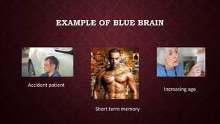 EXAMPLE OF BLUE BRAIN
Accident patient
Short term memory
Increasing age
 