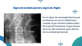 Signos radiologicos abdomen, pelvis y senos paranasales | PDF