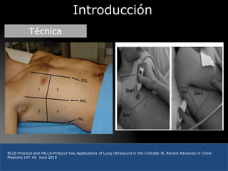 blue protocol Bedside lung Ultrasound in emergency | PPTX